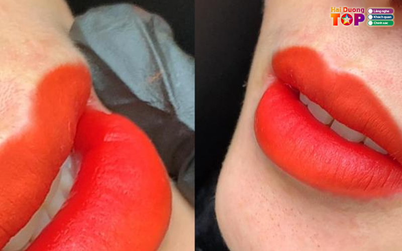 Diamond-spa-haiduongtoplist