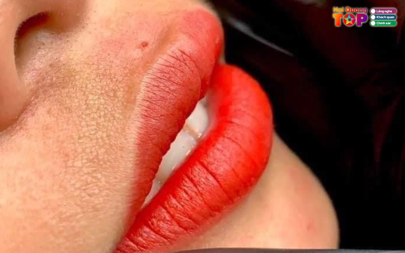 Tham-my-amelinda-haiduongtoplist