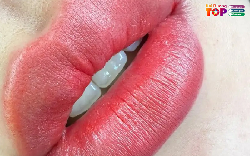 Tham-my-tam-xinh-haiduongtoplist