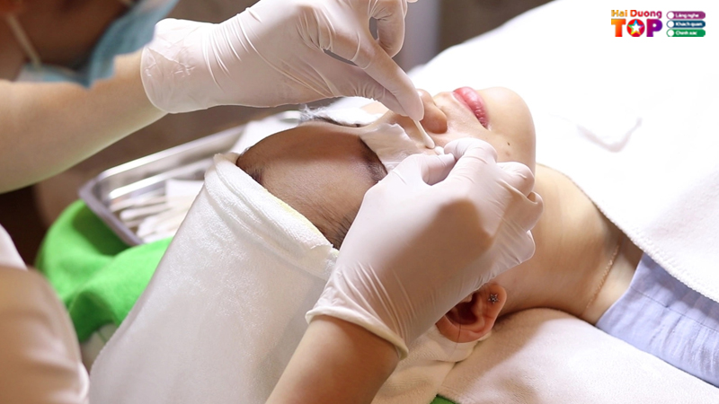 Dieu-tri-mun-o-hai-duong