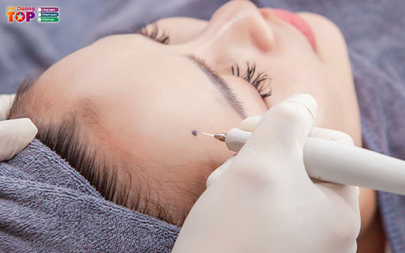 Nem-beauty-center-haiduongtoplist